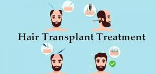 Hair Transplant in Rajkot - Best Hair Transplant Centre in Rajkot