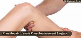Knee Repair to avoid Knee Replacement Surgery - Arthroscopy in Gujarat
